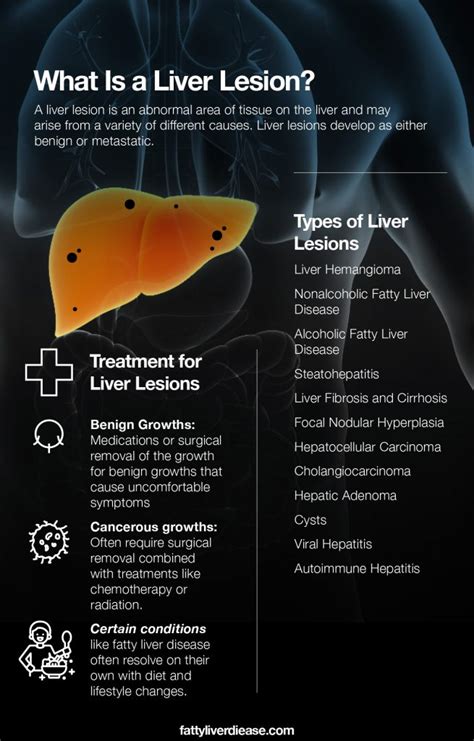 What Does It Mean to Have Liver Lesions? - Fatty Liver Disease