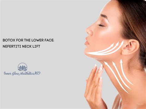 Botox for the Lower Face - Nefertiti Neck Lift - Inner Glow ...