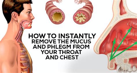 How to Get Rid of Phlegm and Mucus in Chest & Throat - Hecspot | Mucus ...