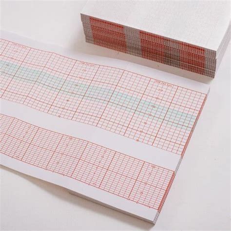 8.5" x 11", Z Fold ECG Recording Chart Paper Pad | Panda Paper Roll