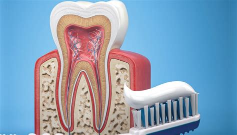 The Delicate Balance of Remineralization and Demineralization - Decisions in Dentistry