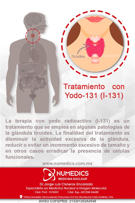 Tratamiento con Yodo - MEDICINA NUCLEAR DE CHIAPAS