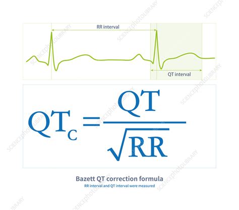 Bazett QT correction formula, illustration - Stock Image - C056/9032 - Science Photo Library