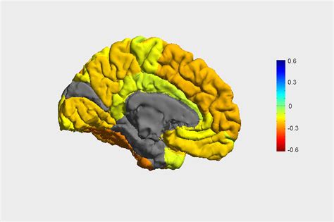 Researchers create roadmap of bipolar disorder and how it affects the ...