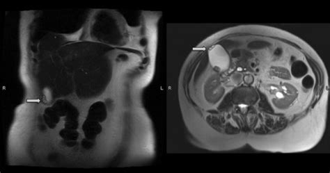 A literature review of radiological findings to guide the diagnosis of ...