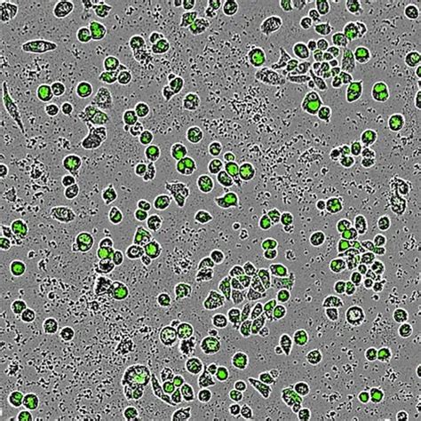 Phagocytosis Microscope