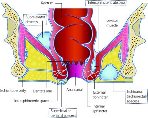 Paraproctitis and Anorectal Abscess – Drs Diary