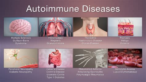 AUTOIMMUNITY: YOUR IMMUNE GONE ROGUE - Imsyser