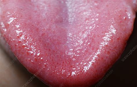 Taste Buds on Tongue Tip - Stock Image - C027/9527 - Science Photo Library