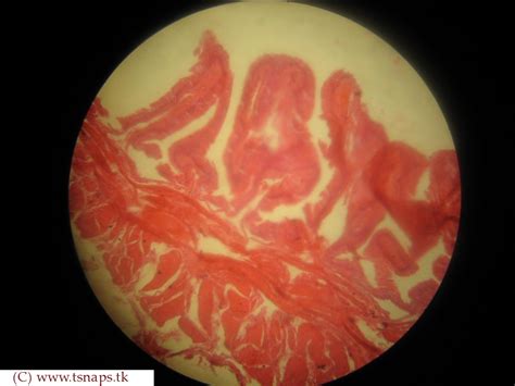 Histology Slides Database: Urinary bladder histology slides