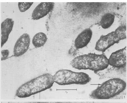 Rickettsia Prowazekii Under A Microscope