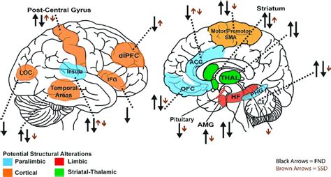 Overview of structural neuroimaging findings in functional neurological ...