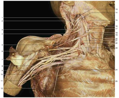 Brachial Plexus Anatomy Cadaver