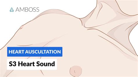 S3 Heart Sound (S3 Gallop) - Heart Auscultation - Episode 9 - YouTube