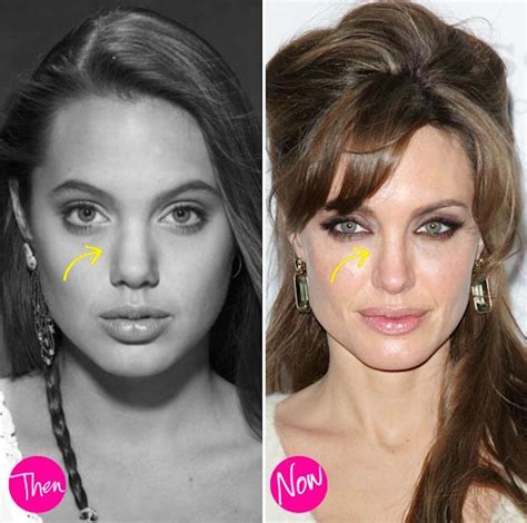 These 15 Celebrities Don’t Want To Tell You They Did a Plastic Surgery ...