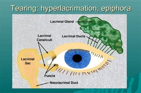 Lacrimal disorders | PPT