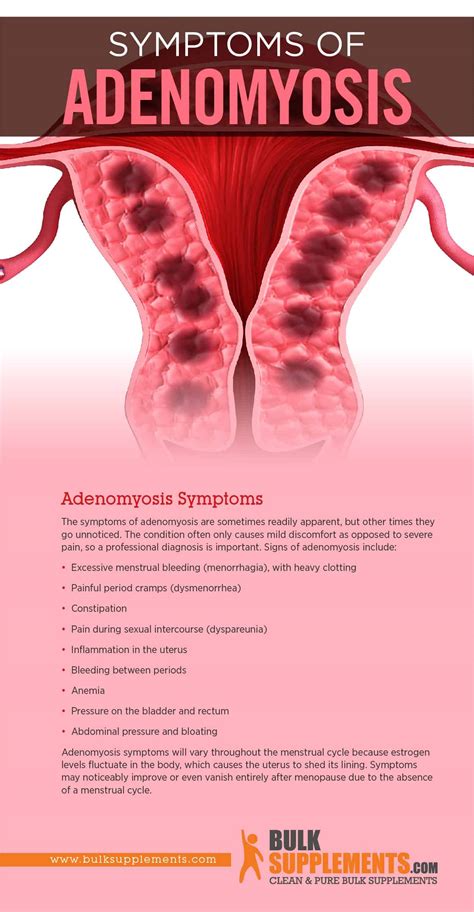 Tablo | Read 'Adenomyosis: Causes, Symptoms & Treatment' by