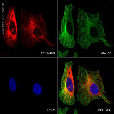 Alexa Fluor® 647 Anti-Cytokeratin 8 抗体 [EP1628Y] (ab192468)