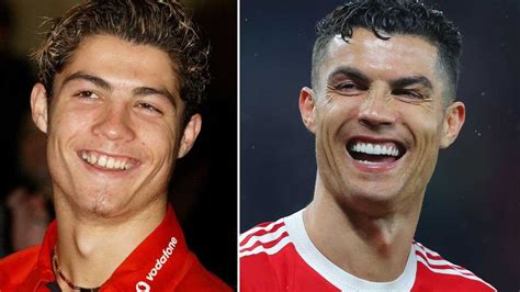 Cristiano Ronaldo smile transformation before and after: What has the footballer done to his ...