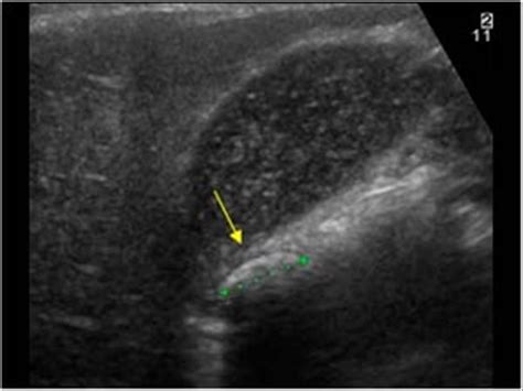 Abdomen and retroperitoneum | 1.2 Gallbladder and bile ducts : Case 1.2 ...