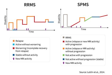 Multiple sclerosis clinical trials – Fighting for a cure