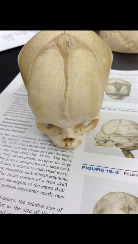 Fetal skull 2 Fetal, Anatomy And Physiology, Biomedical, Study Guide, In The Heights, Skull ...