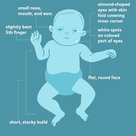 Down Syndrome: Signs, Symptoms, and Characteristics