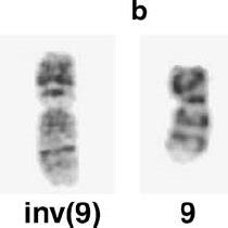 (PDF) Constitutional pericentric inversion of chromosome 9 and ...