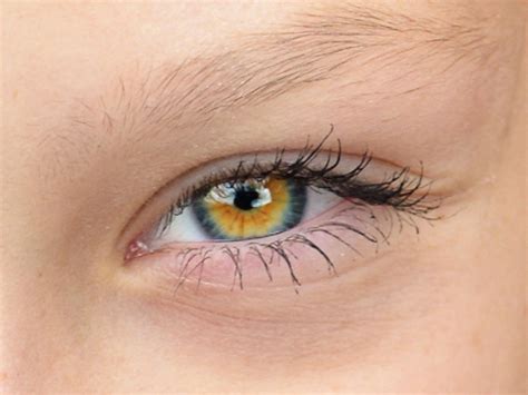 Central Heterochromia Pretty Eyes Beautiful Eyes Diff - vrogue.co