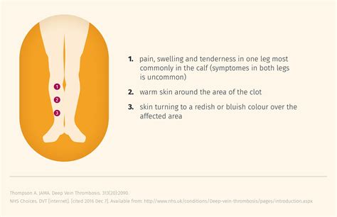 Signs and Symptoms DVT | Thrombosis Adviser