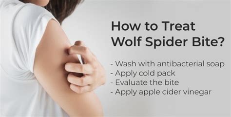 7 Home Remedies to Treat Wolf Spider Bite | Daily Health Cures