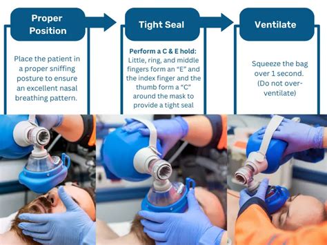 Bag Valve Mask BVM Ventilation Ambu Bag CPR Select