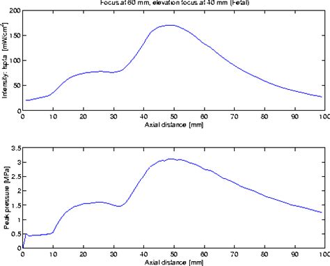 Field II Ultrasound Simulation Program