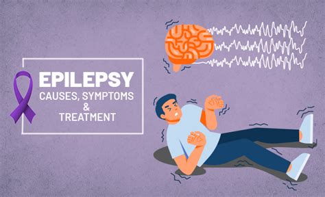 Epilepsy- Causes, Symptoms and Treatment | Accord Hospital