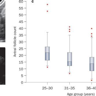 Antral follicle count.Transvaginal ultrasound images reflect a | high ...