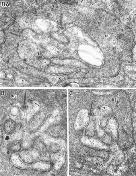 Three examples of the horizontal cell synapses in which the rod ...