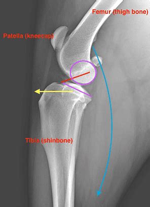 TPLO & TTA Surgery - Court Street Vets