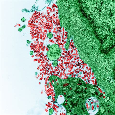 Rabies virus - Wikipedia