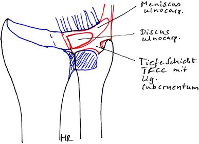 Anatomy of the distal radioulnar joint and TFCC | Download Scientific ...