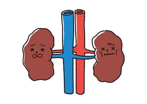 An Unhealthy Kidney Mascot Renal Failure Stock Illustration - Download ...