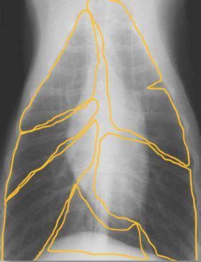 Výsledek obrázku pro canine lung lobe torsion radiograph | Lung lobes, Radiographer, Canine