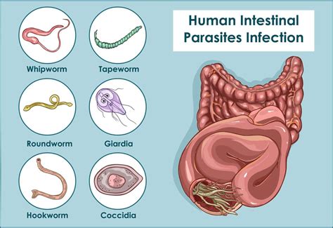 Full Moons and Parasites: the Scientifically Spooky Explanation - Dr. Jess MD | Intestinal ...