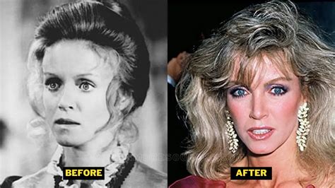 Donna Mills Plastic Surgery. Relationship With Richard Holland, And Her ...