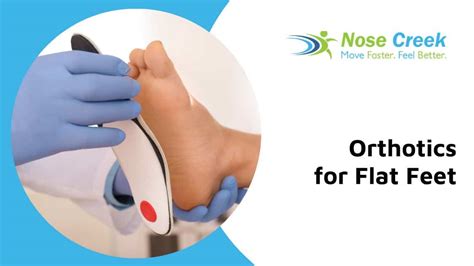 Nose Creek Physiotherapy Can Help Your Flat Feet With Custom Orthotics