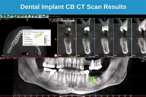 Cone Beam Ct Dental