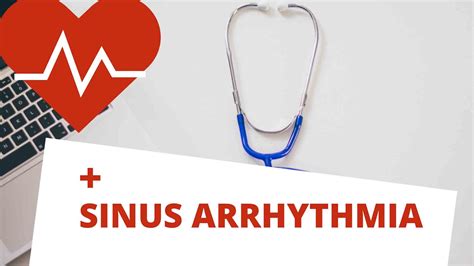 Sinus Arrhythmia: Types, Symptoms, Treatment and more