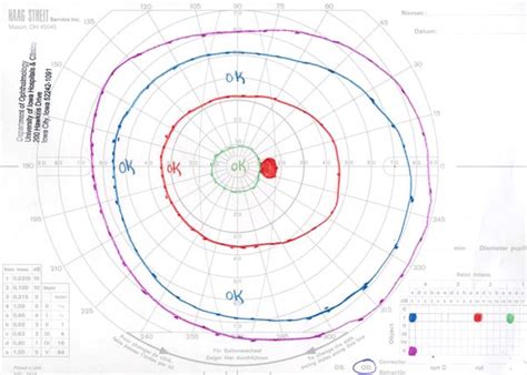 Manual Visual Field Test