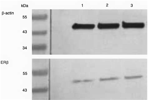 This figure provided exhibits an exemplar of a western blot membrane ...