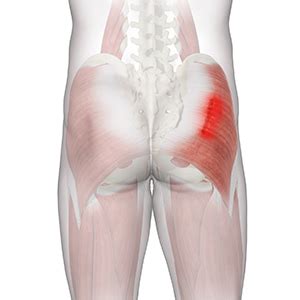 Gluteal Strain Treatment Southington | Hip Pain Treatment Wallingford, Meriden