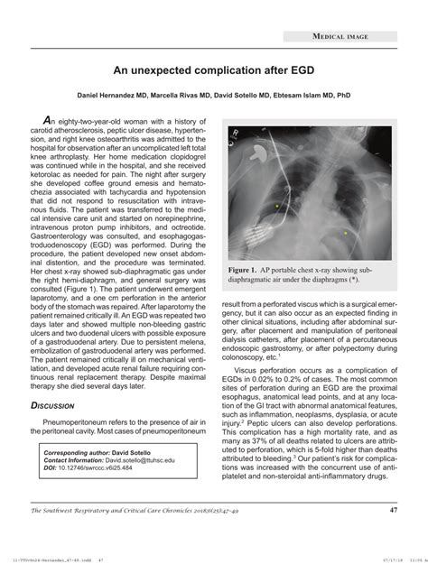 (PDF) An unexpected complication after EGD